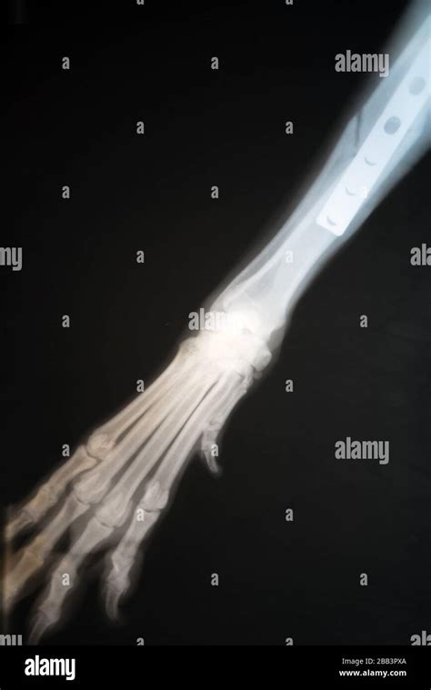 X Ray Of Dogs Paw Fracture Radiograph Of The Broken Paw Of A Dog