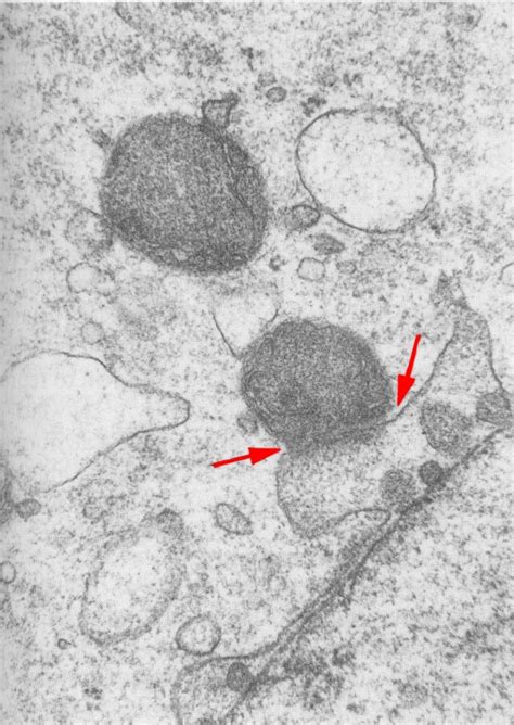 Carnegie Stage 2 50 Blebs Protruding From The Nuclear Membrane