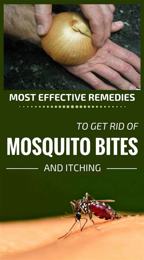 Most Effective Remedies To Get Rid Of Mosquito Bites And Itching