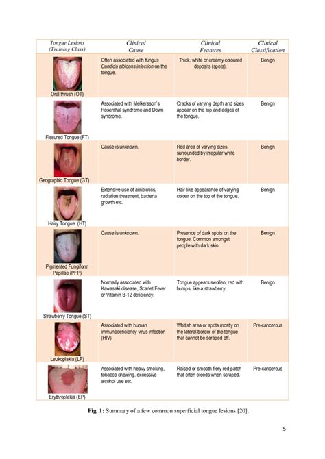 Automated Detection Of Oral Pre Cancerous Tongue Lesions Using Deep Learning For Early Diagnosis