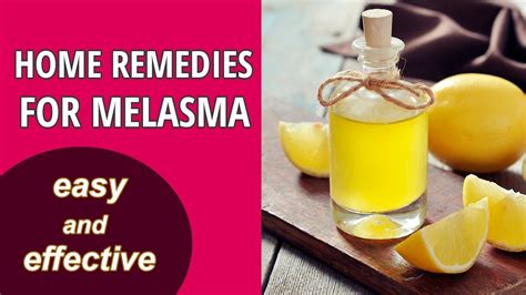 Melasma Home Remedy Treatment 6 Effective Ways Youtube