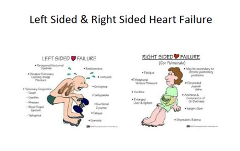 Exemplar 16f Heart Failure Pearson Flashcards Quizlet