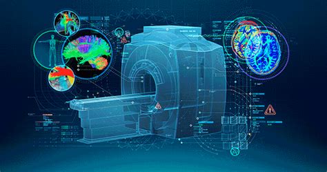 Intelligent Scanning Using Deep Learning For MRI The TensorFlow Blog
