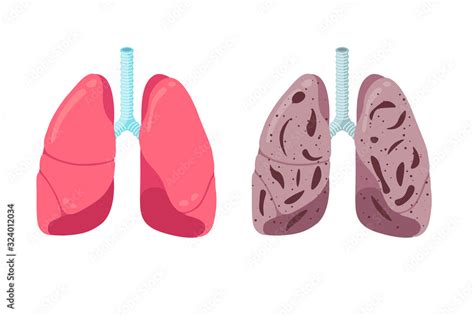 healthy and unhealthy lungs compare concept human respiratory system internal organ strong and