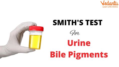 Bile Salts In The Urine Introduction Composition And Test Procedure
