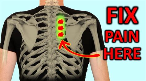Rhomboid Pain How To Fix Shoulder Blade Pain Quickly Youtube
