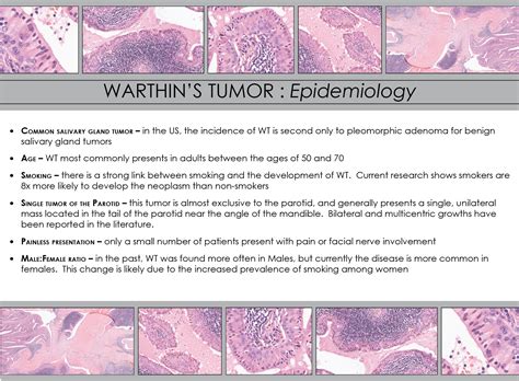 Warthins Tumor Iowa Head And Neck Protocols