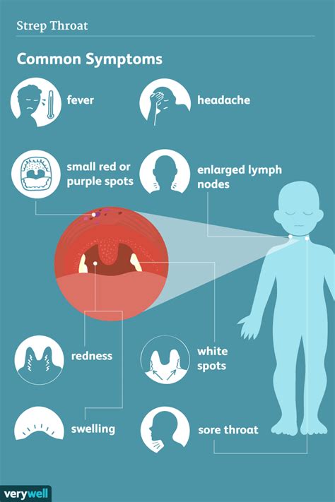 Les Symptômes De Langine Streptococcique