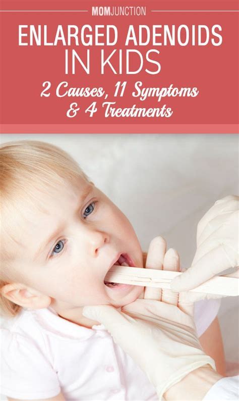 Enlarged Adenoids In Kids 2 Causes 11 Symptoms And 4 Treatments