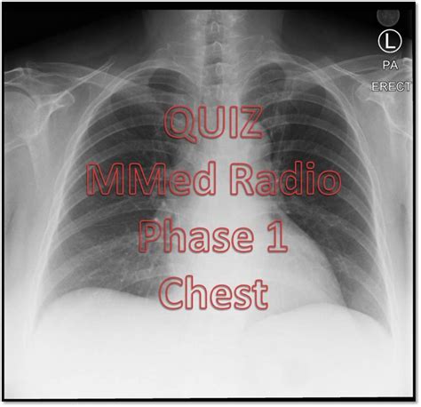Quiz 30 Chest Radiology Cases