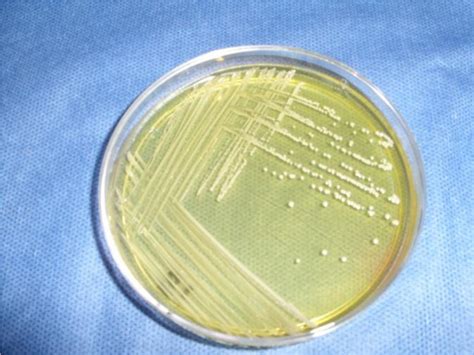 Staphylococcus Aureus Colony Morphology