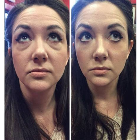2 Minutes Instantly Eye Bag Removal Cream Long Lasting Effect Puffiness