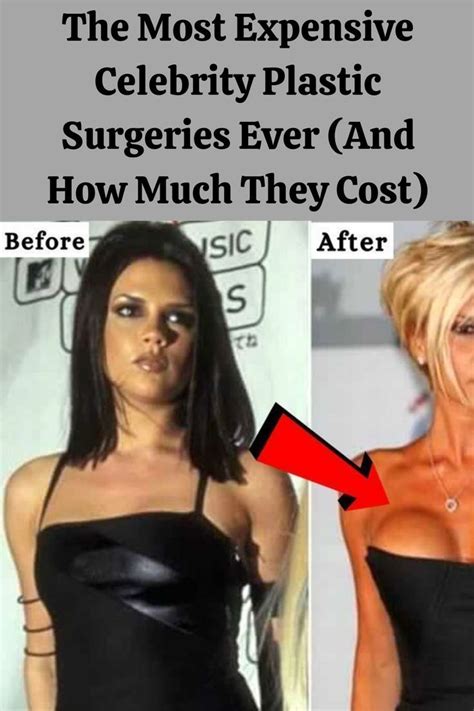 The Most Expensive Celebrity Plastic Surgeries Ever And How Much They Cost Celebrity Plastic