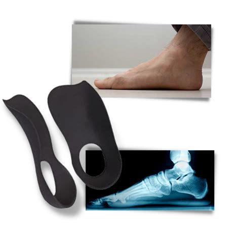 Insole For Flat Feet │ Orthopedic Insoles For Flat Feet │ Insole Ozerty