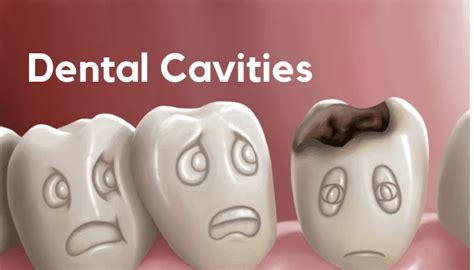 Dental Cavities Causes And How To Prevent Them Vistadent