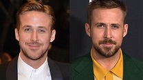 Ryan Gosling Plastic Surgery Before and After Pictures 2022