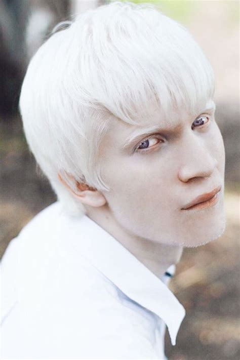 Most Popular Tags For This Image Include Albino Eyes Russian Model