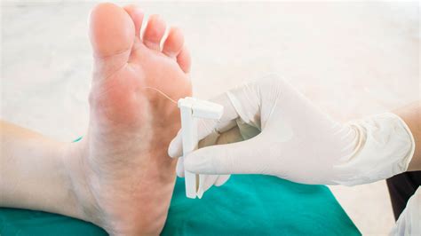 diabetic foot care diabetic foot check and treatment foot centric