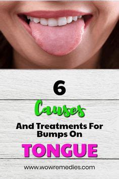 Best Bumps On Tongue Ideas Bumps On Tongue Tongue Bump Momcute Sexiz Pix