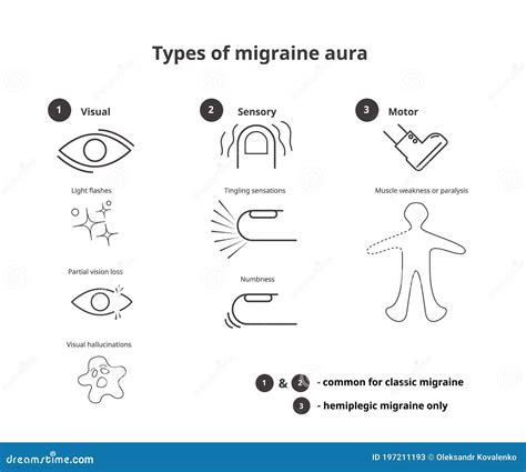 Types Of Migraine Aura Sensory Visual And Motor Aura Of The Classic