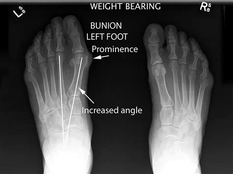 Mackie Orthopaedics Common Foot Conditions