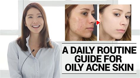 How To Cure Oily Acne Prone Skin A Daily Routine Guide Youtube