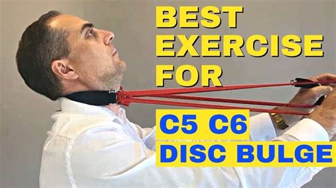 Best Exercises For C5 C6 Bulging Disc C5 C6 Herniated Disc Exercises