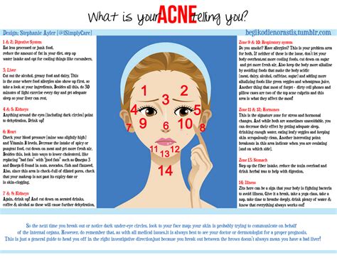 what is your acne telling you no more acne for me in years but i find this surprisingly