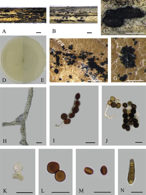 Morphology Of A Gaoyouense From Phragmites Australis Bjfc S1413