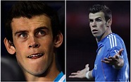 FOTOS: Antes y después de futbolistas que se operaron el rostro ...