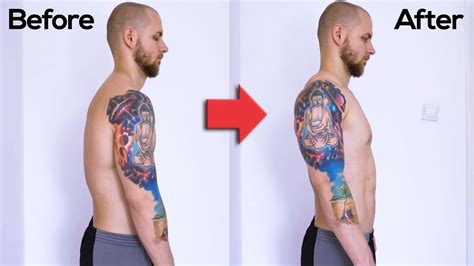 Forward head posture (aka forward neck posture) is an extremely common postural deformity, affecting between 66% and 90% of the population.1. Simple New Yorker: How To Fix My Posture