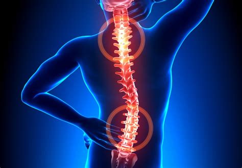 Back Shoulder And Neck Pain Cervical Pain Management In Norwich