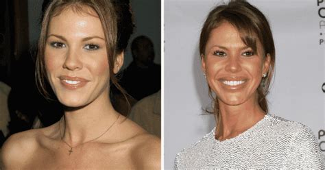 40 Celebrities Who Look Completely Different After Plastic Surgery