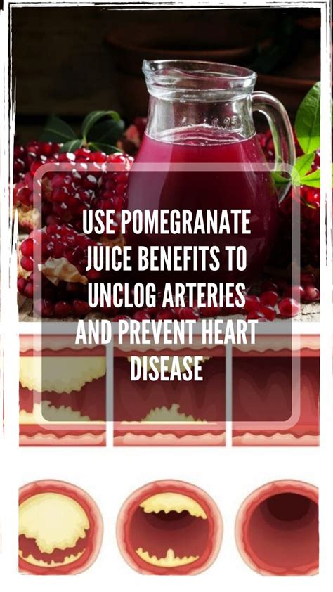Yes, higher intakes are associated with. Use Pomegranate Juice Benefits To Unclog Arteries And ...