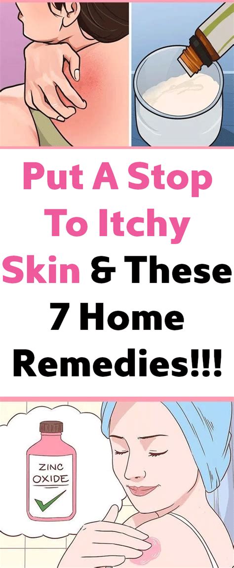 Put A Stop To Itchy Skin And These 7 Home Remedies Remedies Natural