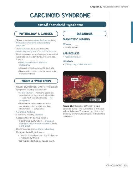 Carcinoid Syndrome Osmosis