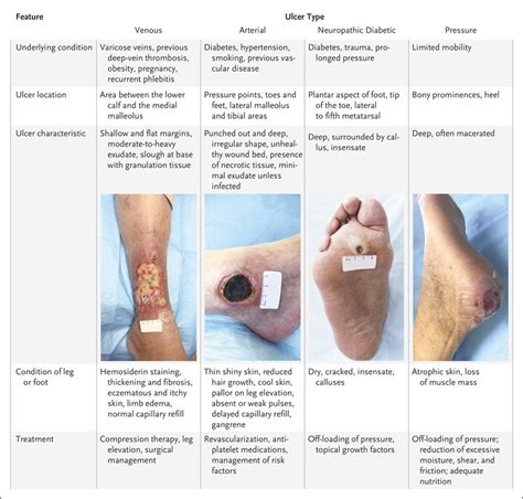 Evaluation And Management Of Lower Extremity Ulcers Nejm