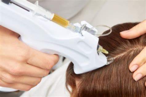 Prp Hair Treatment In Bristol Platelet Rich Plasma Therapy In Bristol