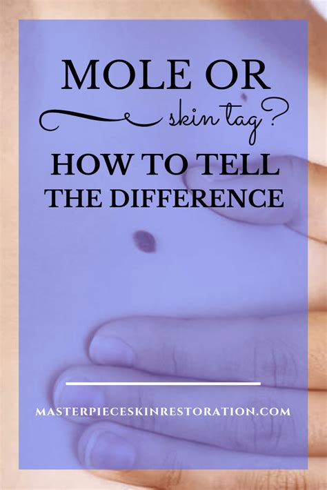 Mark the photos with a date so you know how fast they are growing and changing, if at all. Mole or skin tag? How to Tell the Difference | Masterpiece ...