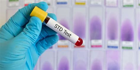 reasons why you should get tested for stds infectus