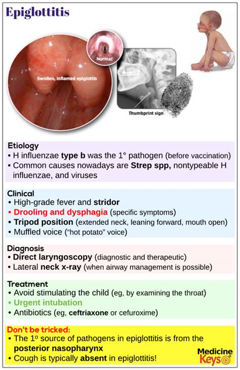 Epiglottitis Medicine Keys For Mrcps