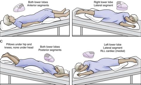 Postural Drainage Therapy