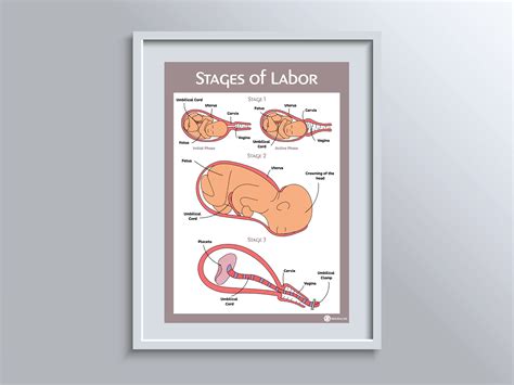 Stages Of Labourlabor Educational Poster Etsy