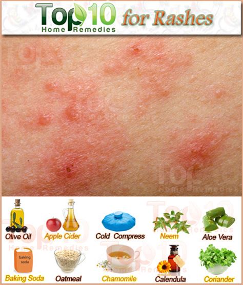 Home Remedies For Skin Rashes And Itching Dorothee