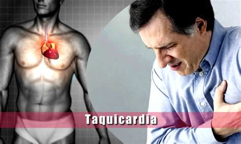 Taquicardia Síntomas Diagnóstico tratamiento y tipos de Taquicardia