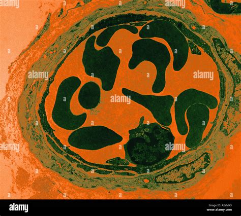 Micrograph Of Blood Vessel Hi Res Stock Photography And Images Alamy