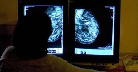 Simple Test Can Detect Breast Cancer In Women Flipboard