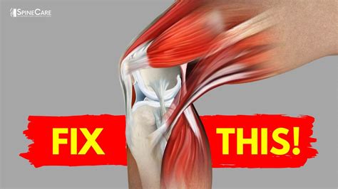 How To Fix Knee Pain For Good At Home Youtube