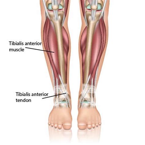 One of the most common causes of front thigh pain is muscle cramping or muscle spasms. Pure Health - ANATOMY101 - The tibialis anterior is a long ...
