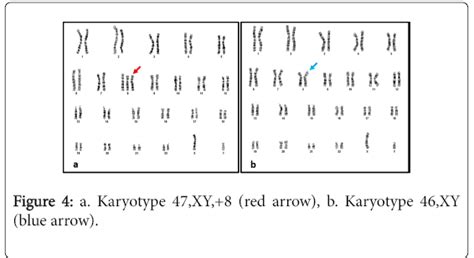 Pigmentary Disorders Karyotype